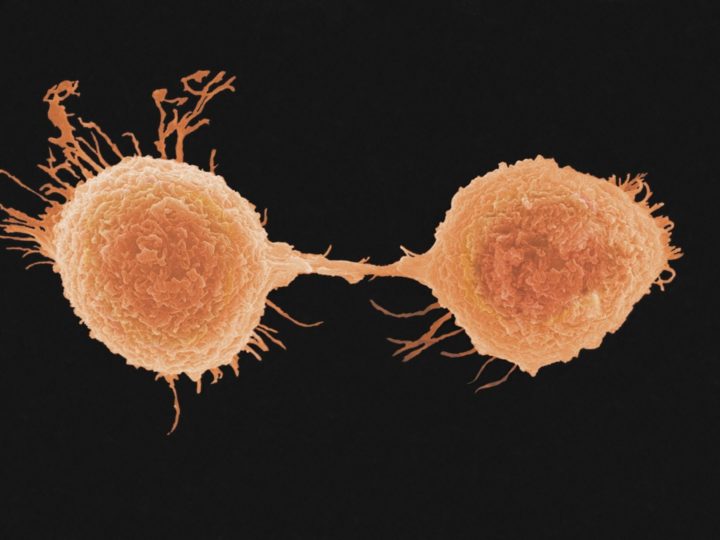 Kebszellen Chemotherapie